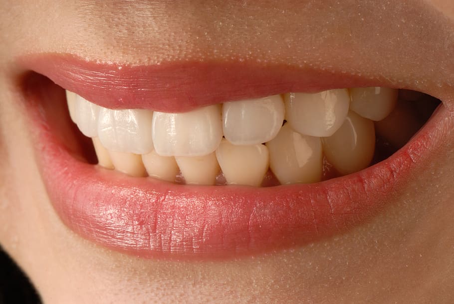 Whitened teeth using activated charcoal